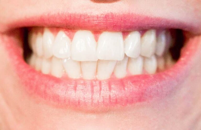 Investigadores del CSIC desarrollan nanopartículas para reparar dientes