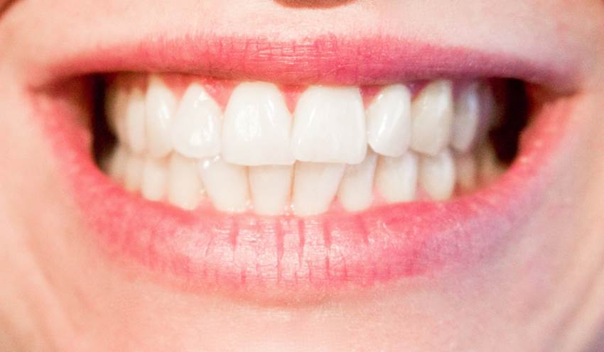 Nuevas nanopartículas permiten remineralizar los dientes