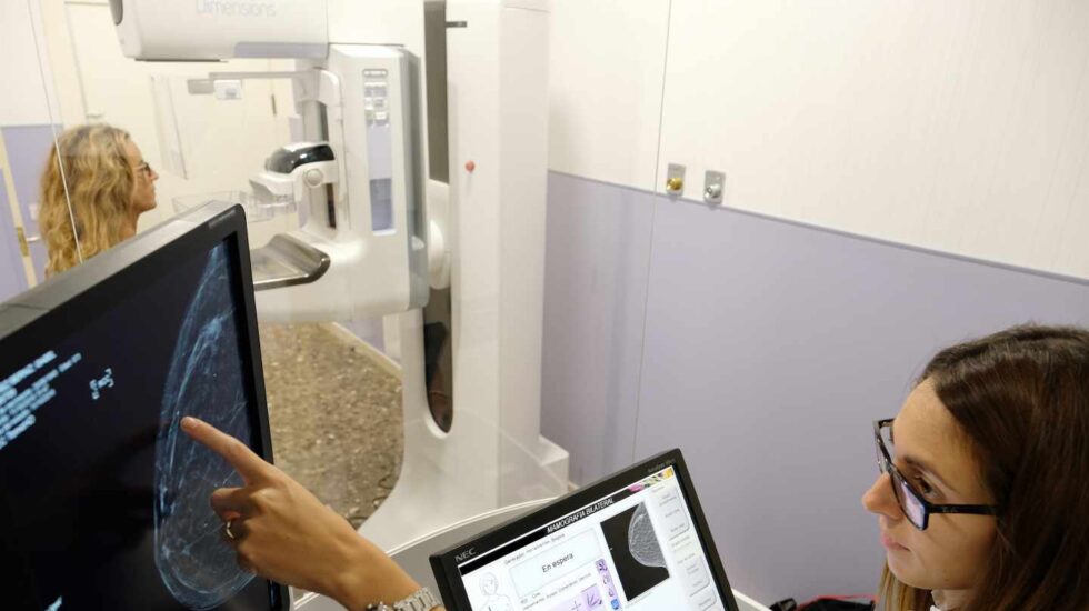 Mamografía a una paciente.