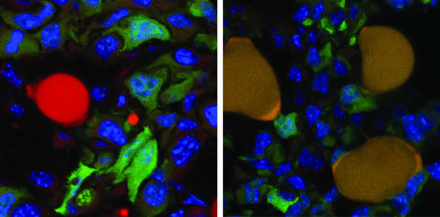 Células de cáncer (verde) convertidas en grasa (naranja)