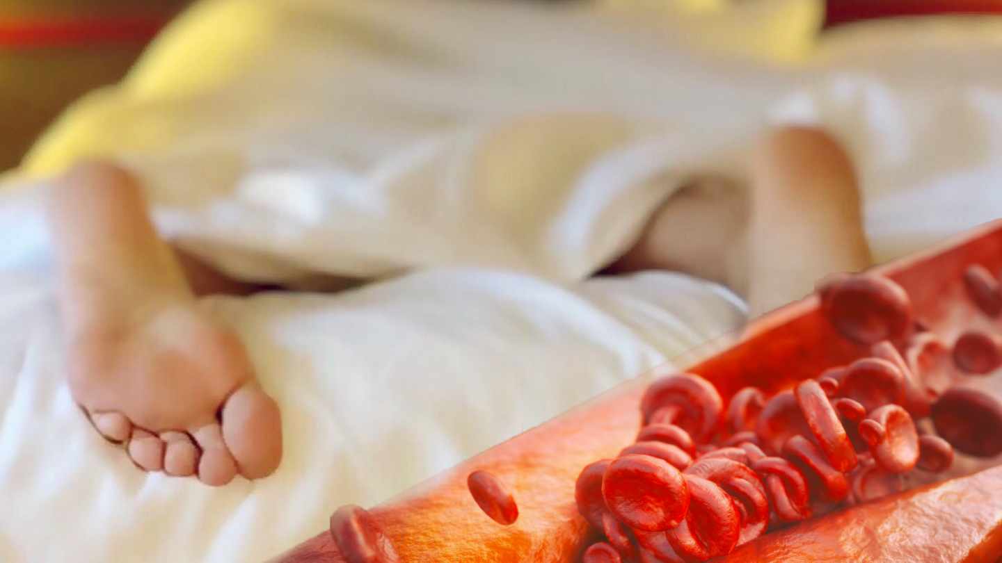 Sueño y arteroesclerosis