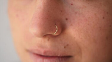 Un piercing en la nariz deja parapléjica a una joven de 20 años