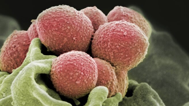 Staphylococcus pyogenes que puede convertirse en bacteria come carne