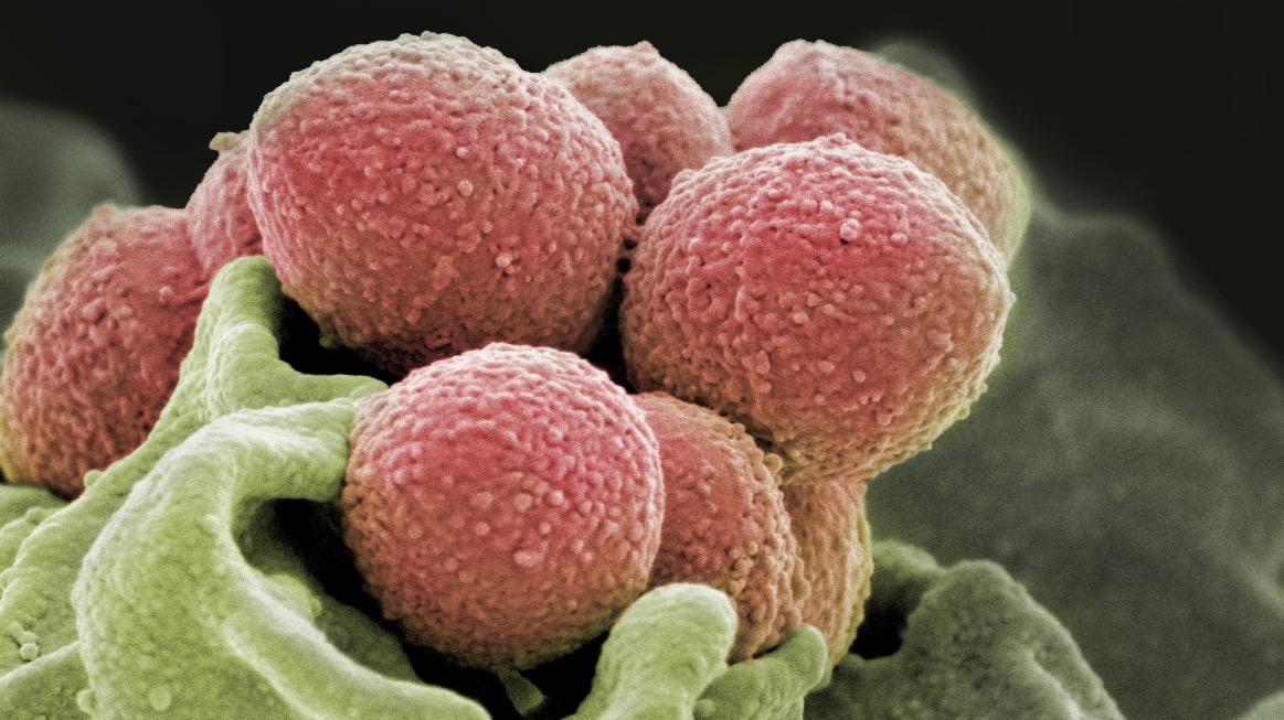 Staphylococcus pyogenes que puede convertirse en bacteria come carne