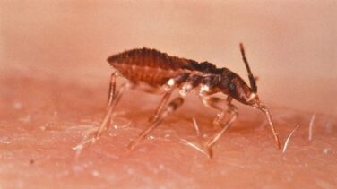 Los casos de la enfermedad de Chagas aumentan en España por la inmigración latinoamericana