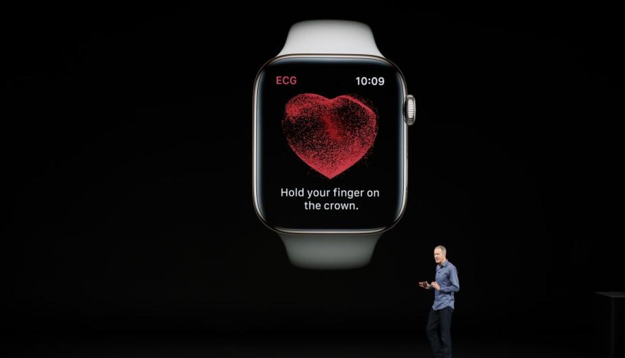 El Apple Watch ya hace electrocardiogramas y le pasa tu historial cardíaco al médico