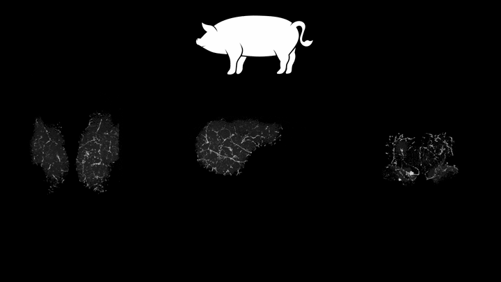 Angiografía de los cerebros 'revividos' de cerdos