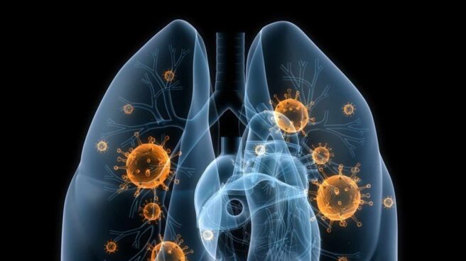 Por qué aumenta el cáncer de pulmón en no fumadores: polución y tabaquismo pasivo