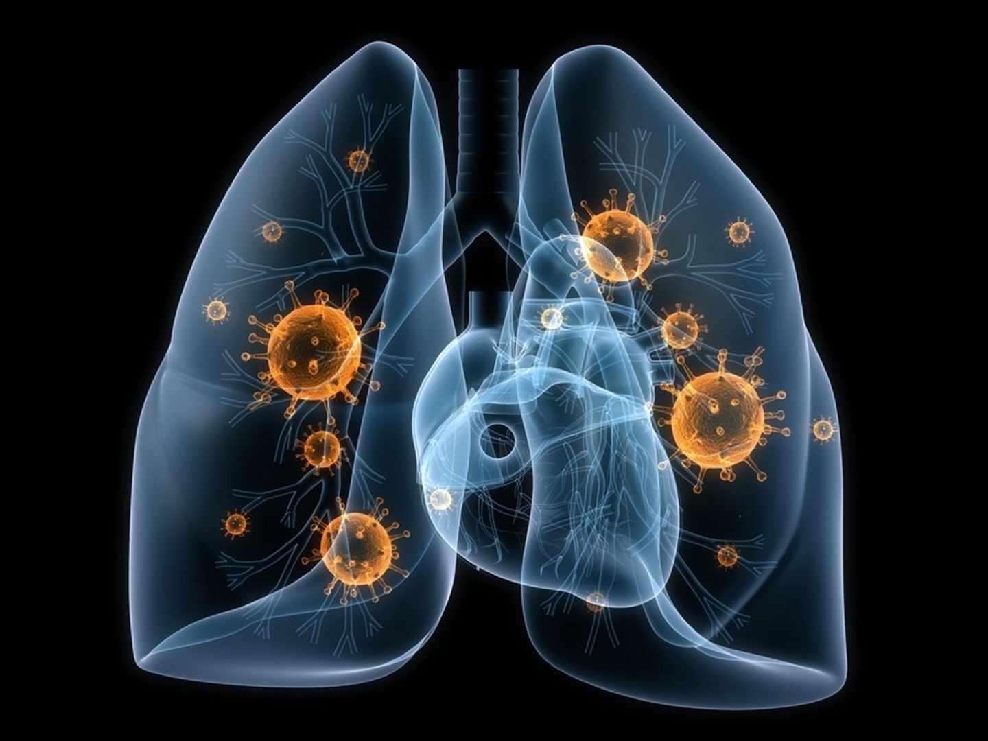 Por qué aumenta el cáncer de pulmón en no fumadores: polución y tabaquismo pasivo