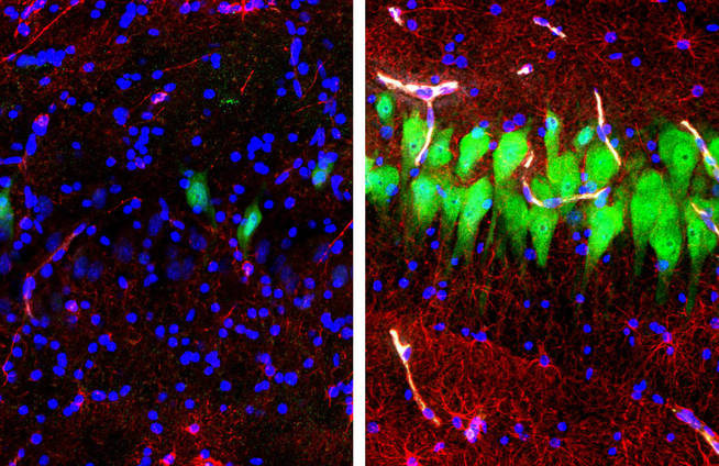 A la izda. células del cerebro muerto. A la dcha., vuelven a mostrar actividad (en verde)