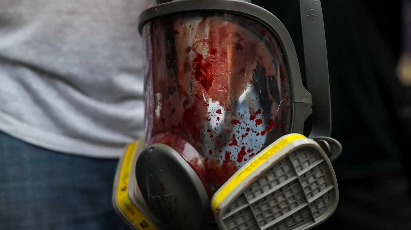 Una máscara antigas, repleta de sangre tras los disparos de la Policía a los manifestantes.