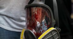 Represión, última arma chavista: "Nunca viste lo peor en Venezuela"