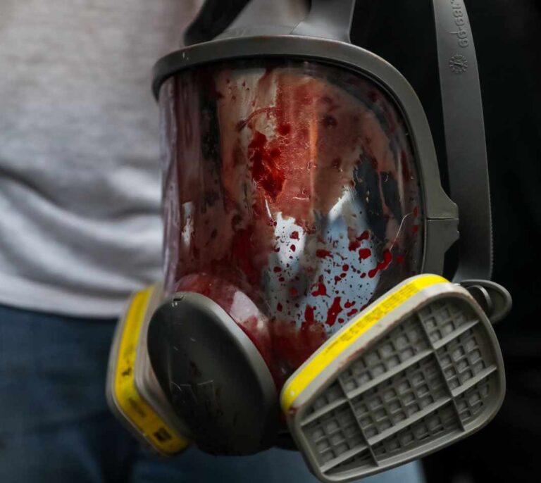 Represión, última arma chavista: "Nunca viste lo peor en Venezuela"