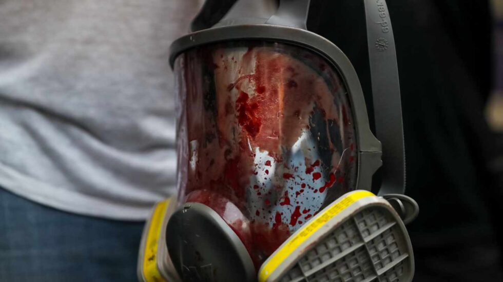 Una máscara antigas, repleta de sangre tras los disparos de la Policía a los manifestantes.