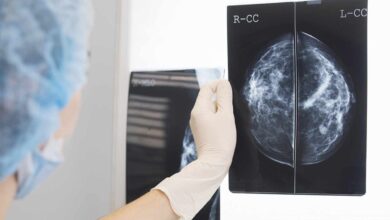 Un medicamento frena el cáncer de mama más agresivo en un 75% de los pacientes