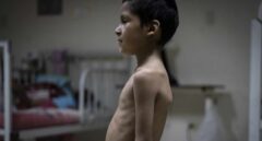 El Pitazo da voz a la generación del hambre en una Venezuela rota