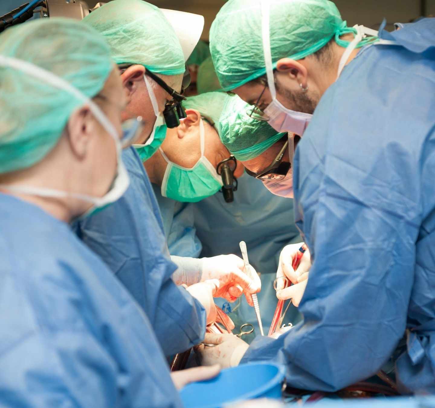 Implantan con éxito un corazón artificial total, el segundo en España