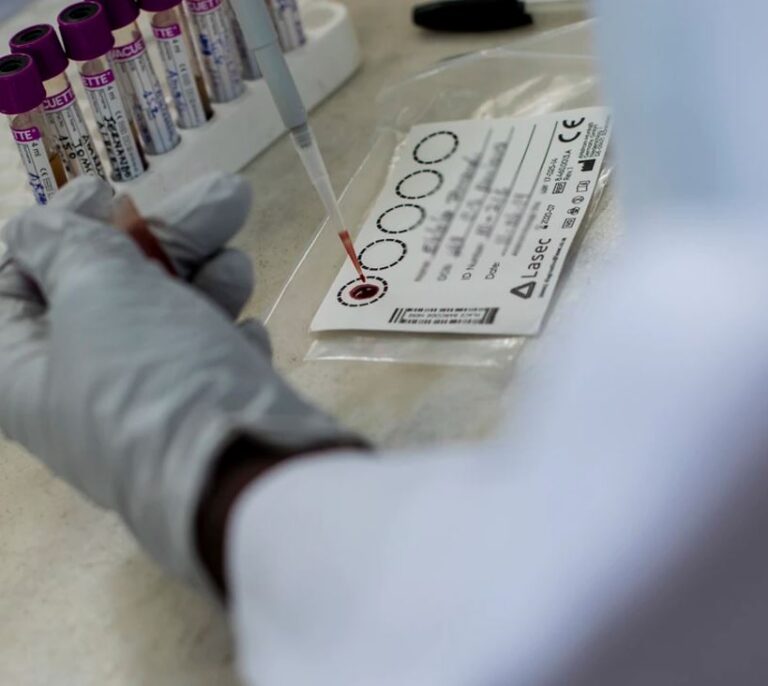 770.000 personas murieron por sida en 2018, una cifra estancada desde 2014