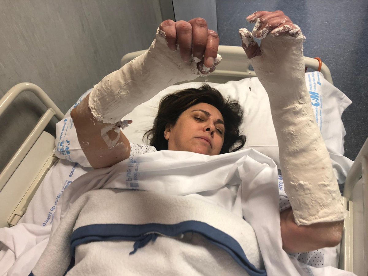 La directiva Rosa García, en el hospital tras romperse las dos muñecas en un accidente.