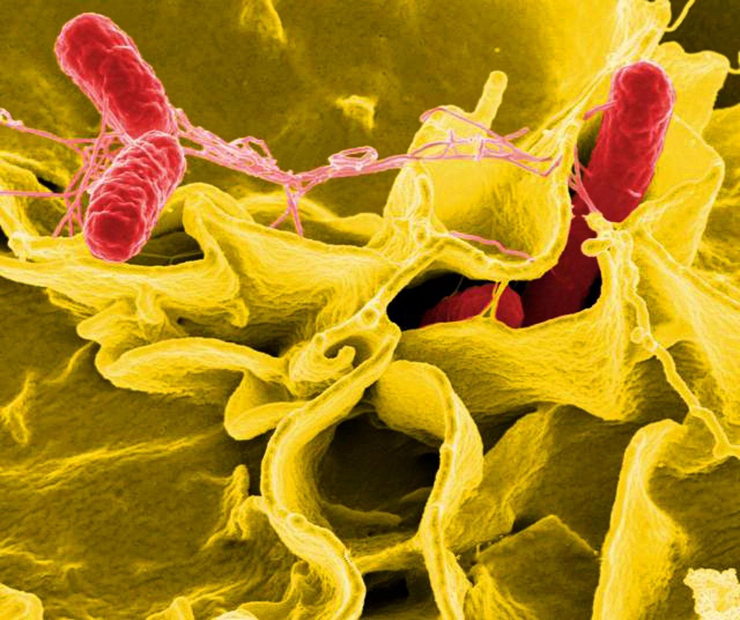 Claves sobre la salmonelosis, la segunda causa de gastroenteritis en España