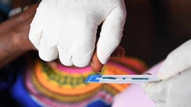 Un estudio subraya la necesidad del abordaje multidisciplinar del paciente con VIH e ir más allá de la supresión viral