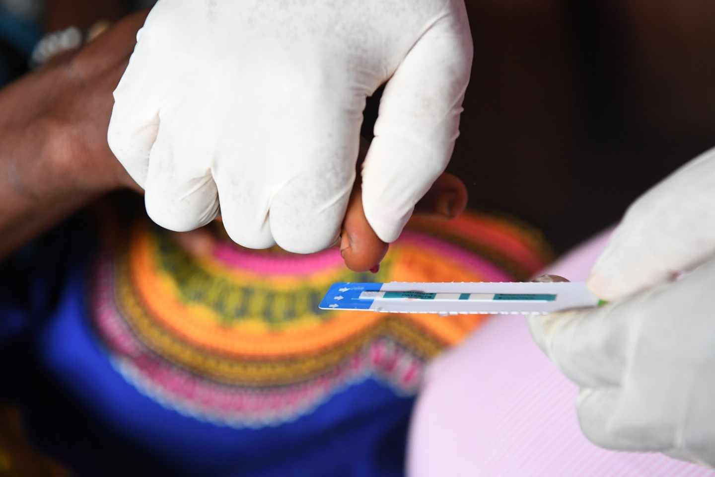 La pastilla preventiva del VIH reduce casi a cero los contagios.