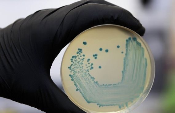 Una placa con la bacteria de listeriosis