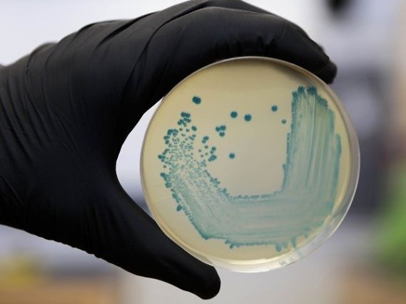 Una placa con la bacteria de listeriosis