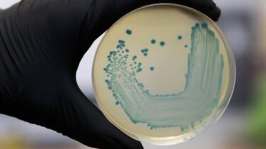Muere en Baleares por listeriosis un paciente de 88 años