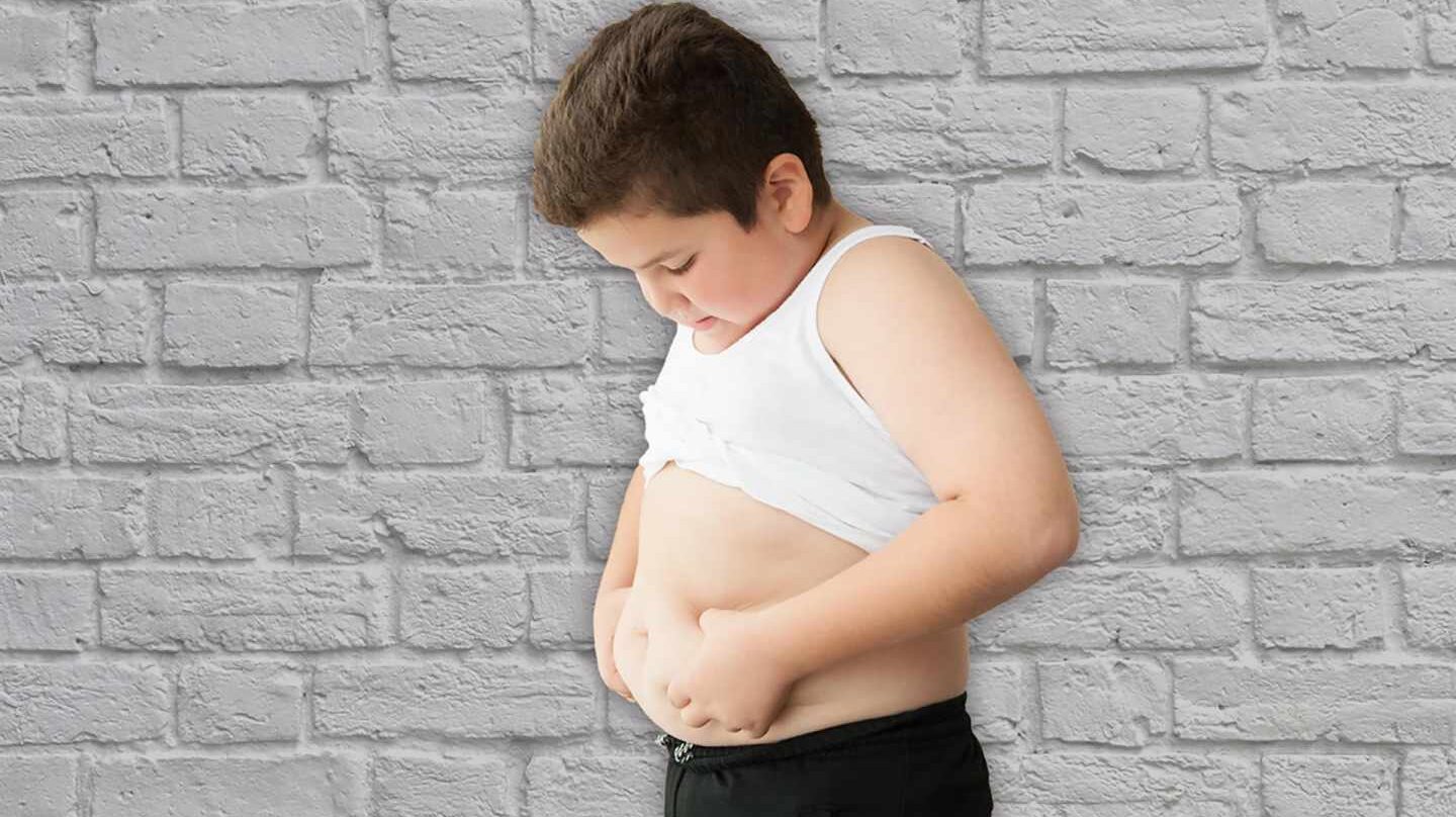 Obesidad infantil