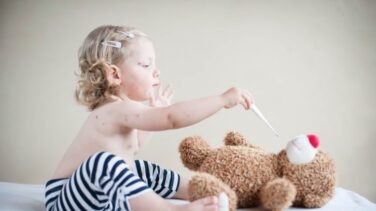 El sarampión deja a los niños no vacunados más vulnerables a otras infecciones