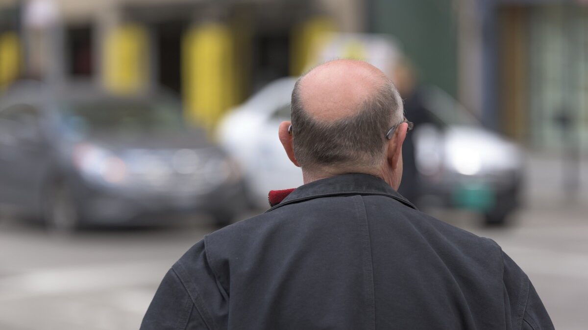 La contaminación del aire provoca pérdida de pelo