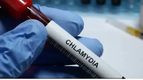 Un estudio apunta a que la infección por clamidia puede dañar la fertilidad masculina