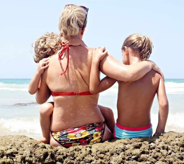 Dolorosa, limitante y no contagiosa: claves de la psoriasis, que sufre un 2% de españoles