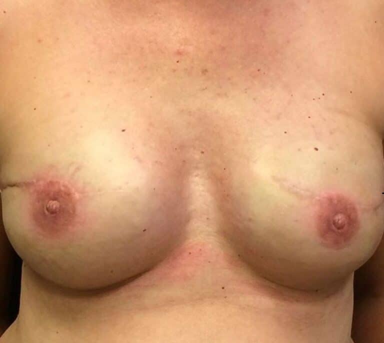 Tamy López, tatuadora de areolas y pezones: "Ayuda a volver a empezar"