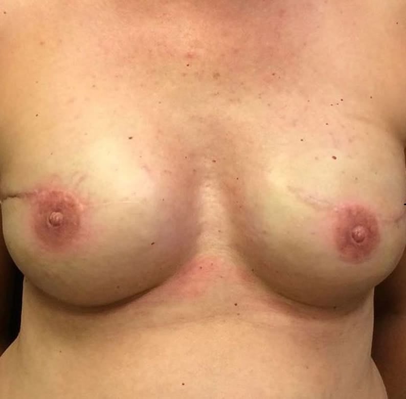 Tatuaje de unas areolas