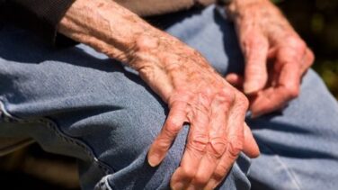 Sanidad dejará de financiar fármacos contra la artrosis por su "baja utilidad terapéutica"