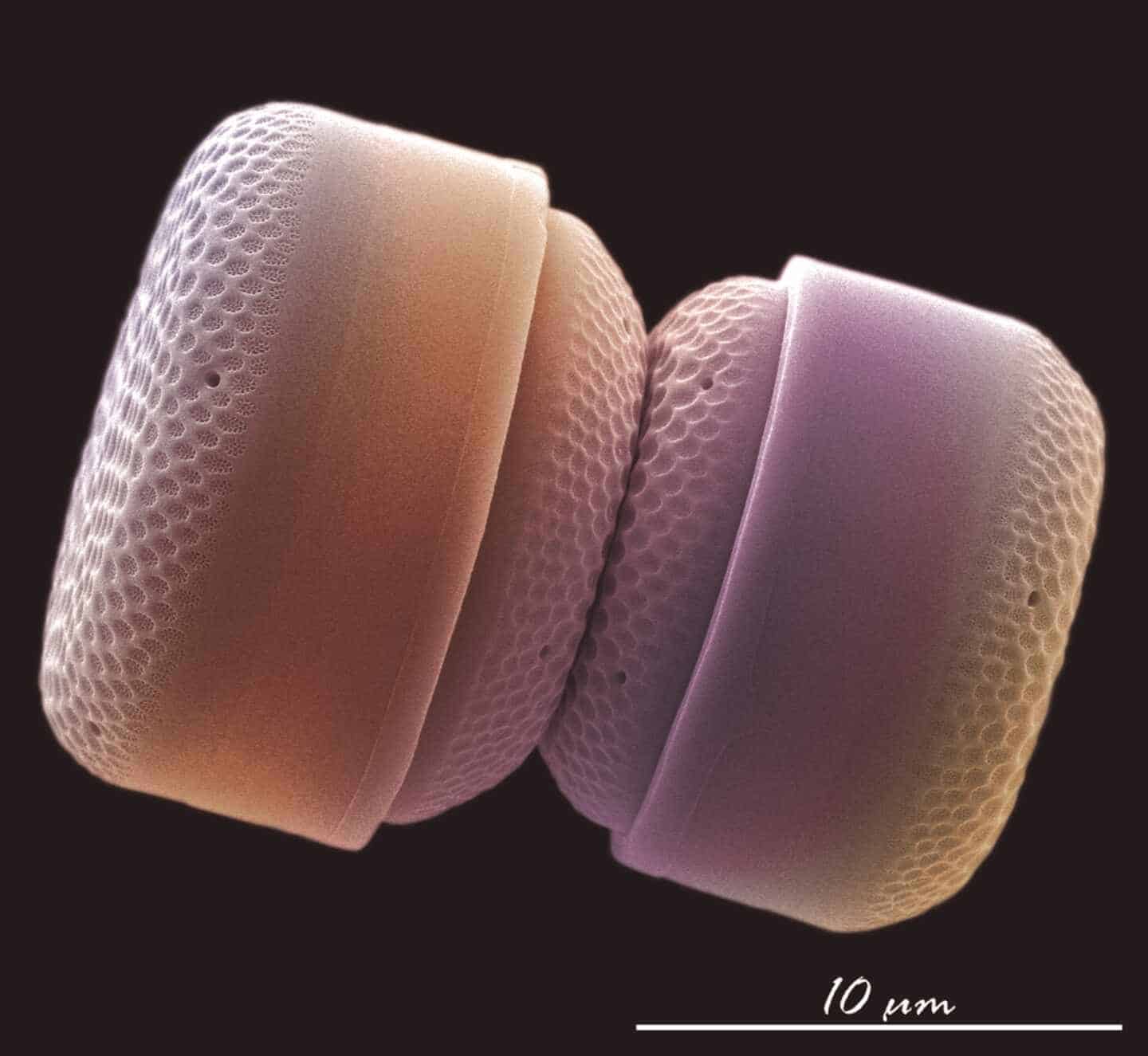 Las mejores fotos de ciencia: el sexo de los crustáceos, caballitos de mar y nanoplancton