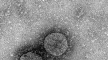 Descartan que la mujer de Valladolid llegada de China tenga coronavirus