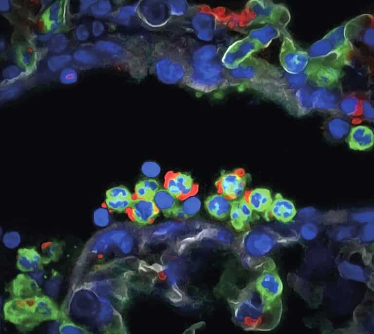 Las defensas tienen 'reloj biológico' que puede ayudar a luchar contra ictus e infartos