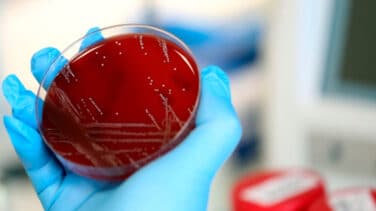 Covid-19: la OMS pone un nuevo nombre al coronavirus