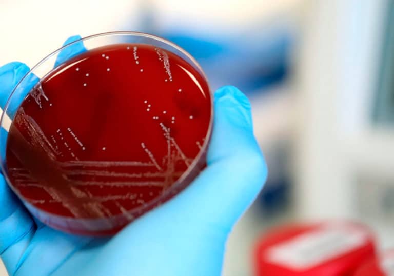 Dos menores infectados por el coronavirus en Castilla-La Mancha