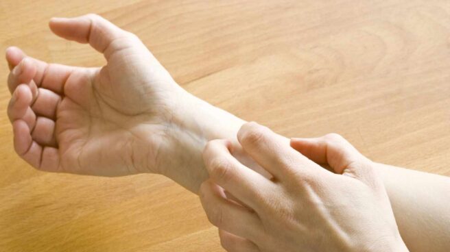 dermatitis