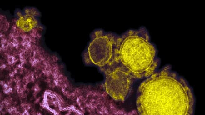 Coronavirus