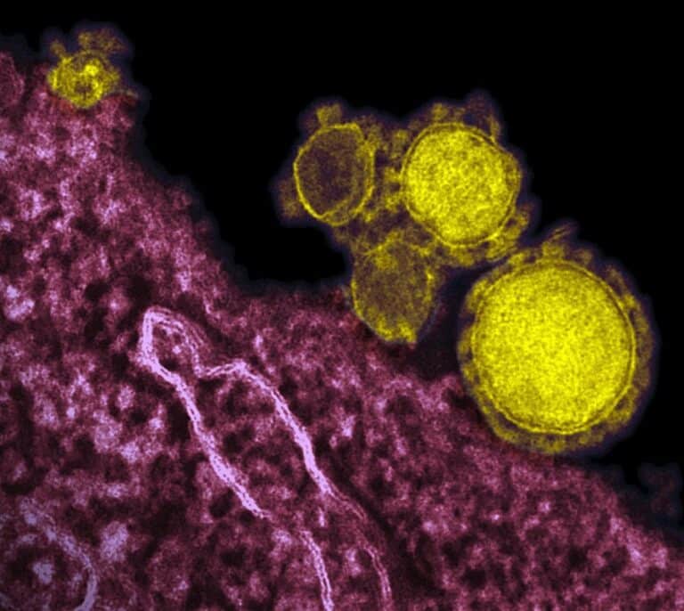Los bulos de la epidemia: ni el pis de niño ni la cocaína te protegen del coronavirus