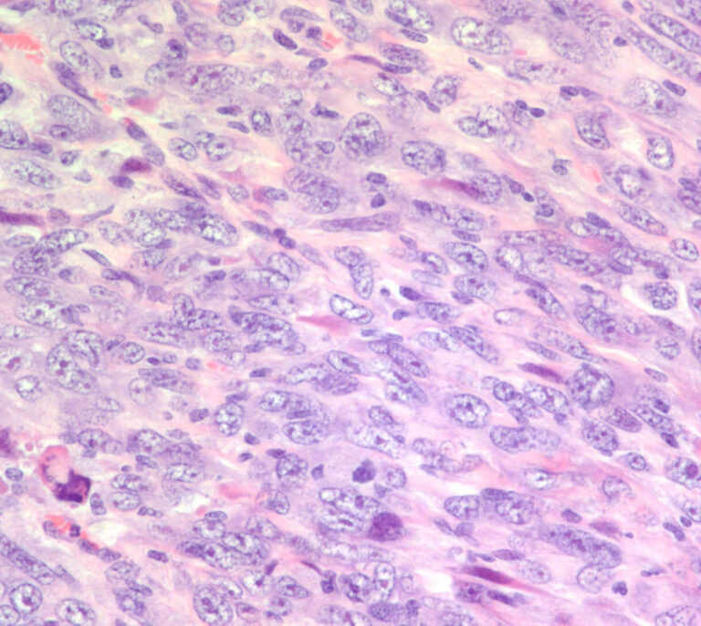 Hallan una terapia eficaz en ratones contra el cáncer más letal por exposición a amianto