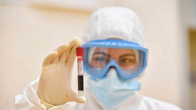 Muestra de análisis de coronavirus.