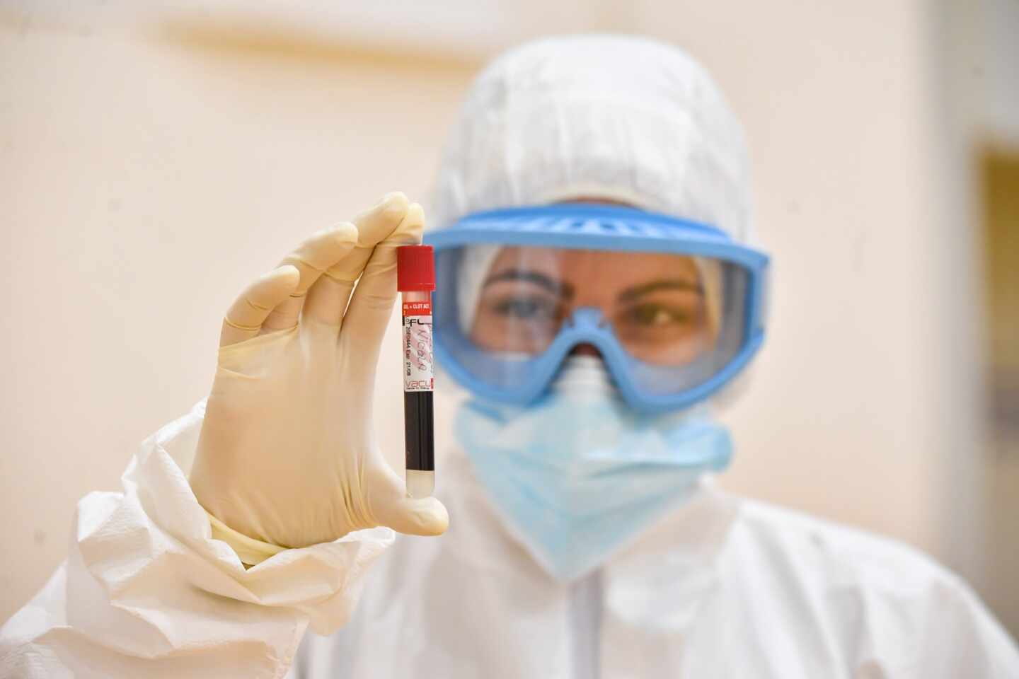 Los laboratorios privados ya han hecho el 6% de los PCR en Cataluña