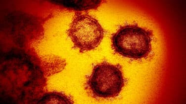 Rusia detecta "mutaciones" del coronavirus en Siberia y avisa de que podría generarse una nueva variante