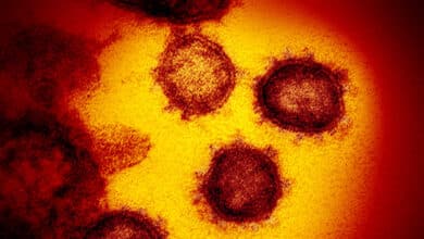 Las epidemias que aún nos acechan: "Hemos tenido suerte con el nuevo coronavirus"